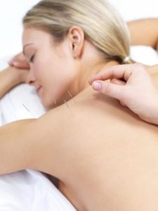 Dry Needling Yarrambat